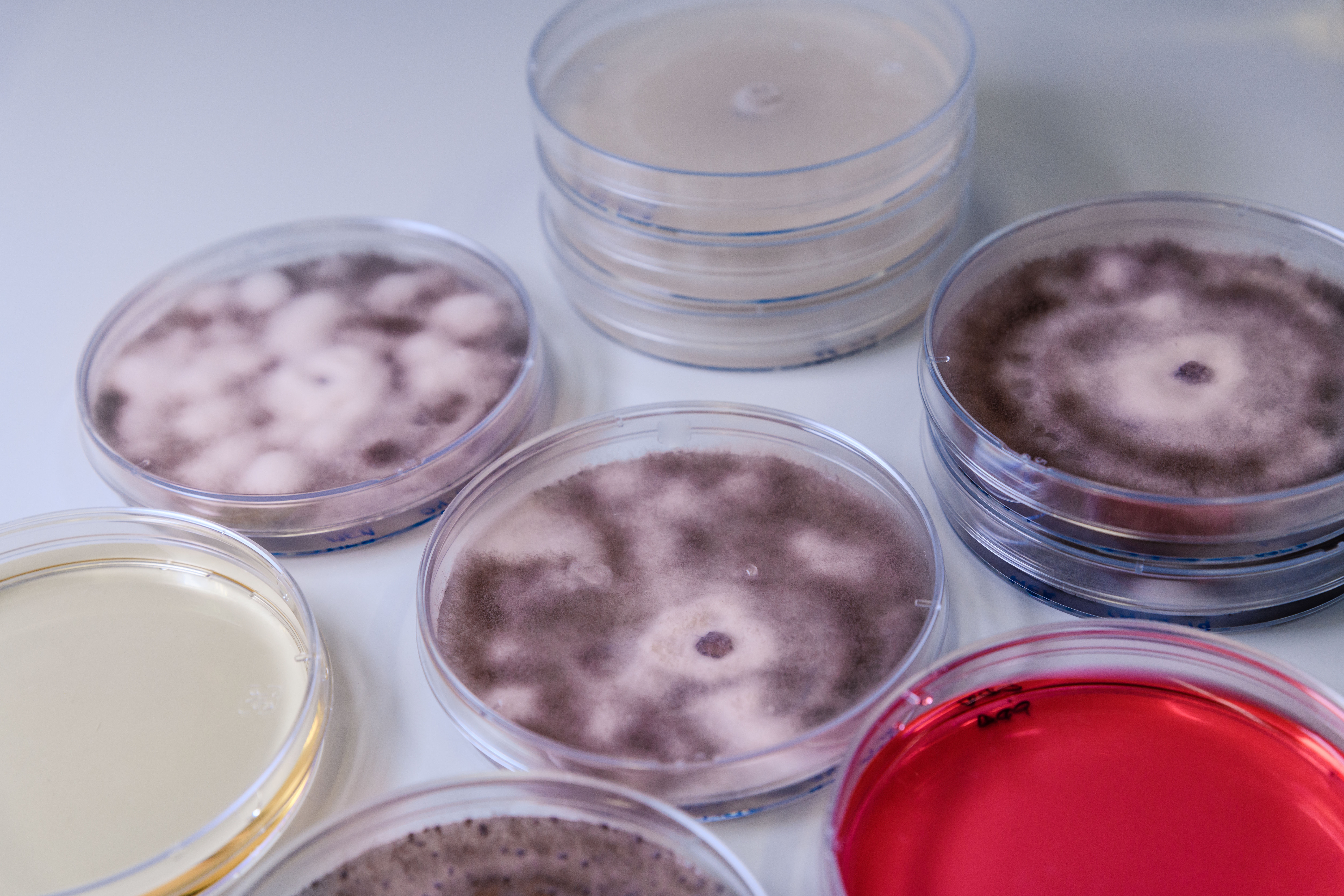 CHROMOGENIC CULTURE MEDIA
